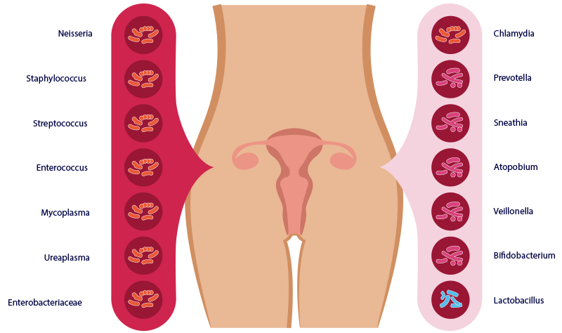 patologije koja je nastala promenom mikrobioma endometriuma