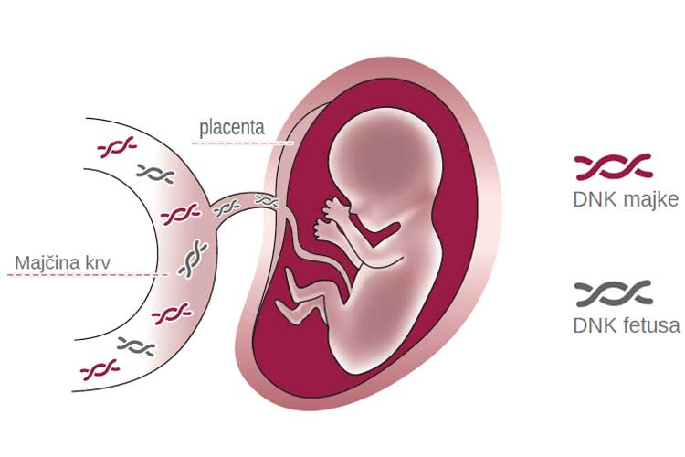 Neinvazivni prenatalni test PrenatalSafe (NIPT)